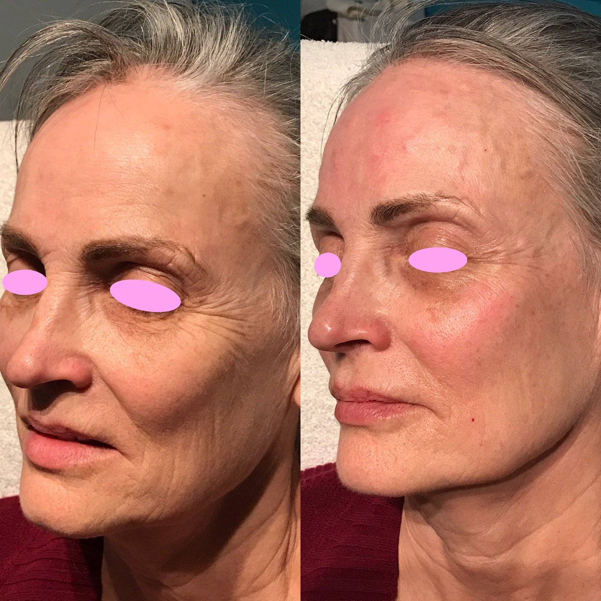 MD Codes Os Códigos do Preenchimento RGO Odontologia