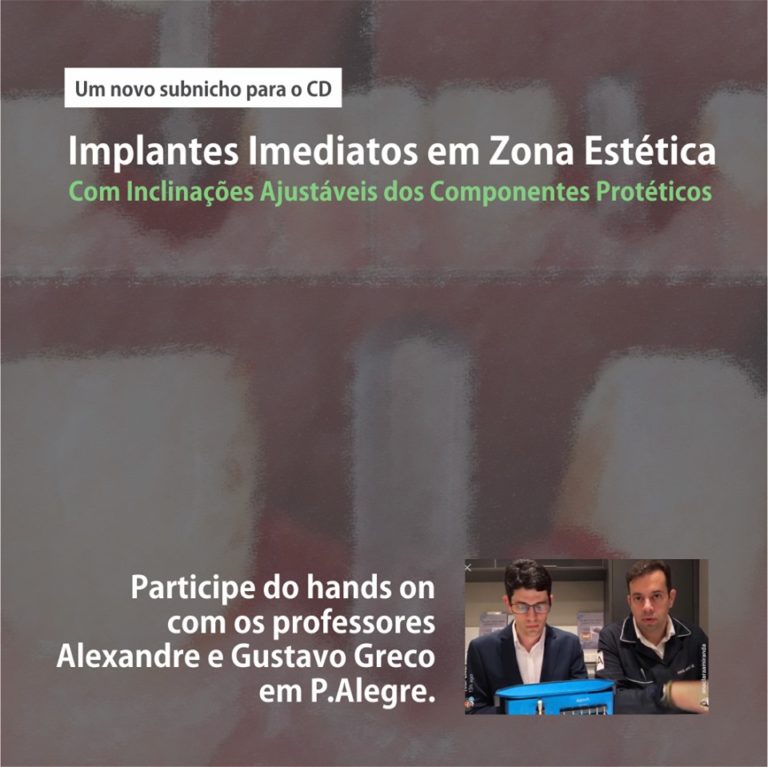 Curso de Implantes Estéticos em Porto Alegre