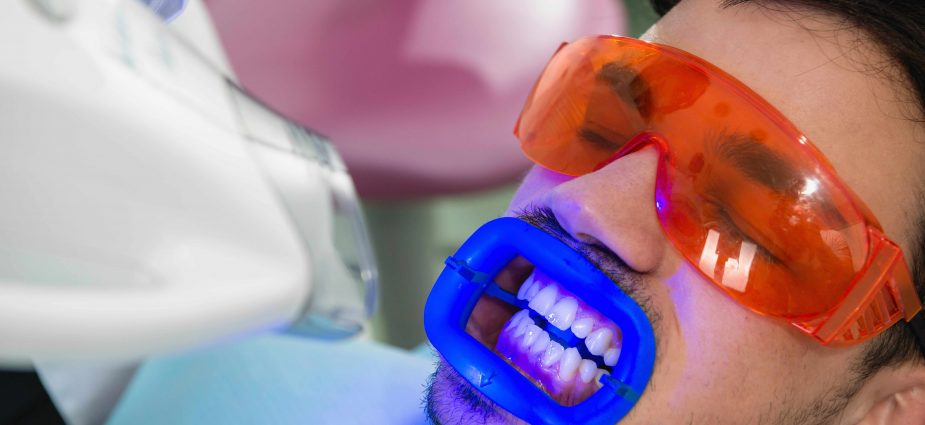 Clareamento Dental no consultório: